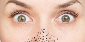 3 Cara Menghilangkan Komedo Hitam Secara Alami dan Efektif Cara Menghilangkan Komedo Hitam Secara Alami dan Efektif