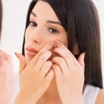 5 Cara Menghilangkan Bekas Jerawat Dengan Cepat Cara menghilangkan bekas jerawat