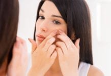 5 Cara Menghilangkan Bekas Jerawat Dengan Cepat Cara menghilangkan bekas jerawat