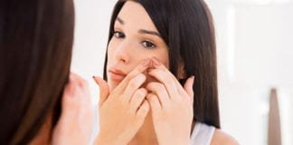 5 Cara Menghilangkan Bekas Jerawat Dengan Cepat Cara menghilangkan bekas jerawat