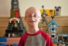Kisah Inspiratif Sam Berns Berjuang Melawan Penyakit Langka Progeria Kisah Inspiratif Sam Berns