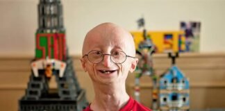Kisah Inspiratif Sam Berns Berjuang Melawan Penyakit Langka Progeria Kisah Inspiratif Sam Berns