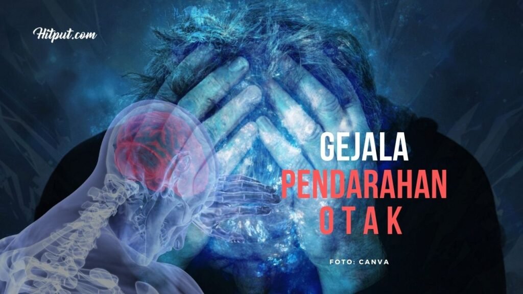 gejala pendarahan otak